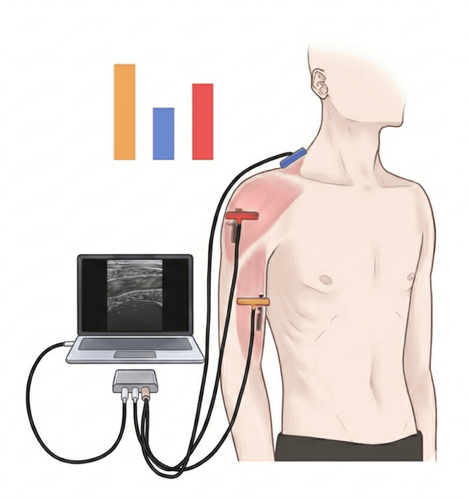 SONoALS Ultrasound Technology